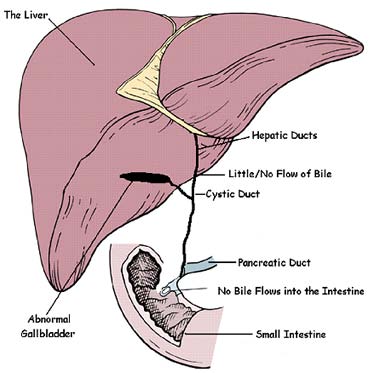 picture of liver